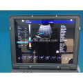 Full Digital Color Doppler Ultrasound Laptop Ultrasound Machine Price Portable 3D Ultrasound Scanner